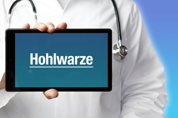 Eingezogene Brustwarzen Emsland